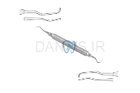 تصویر  گریسی ساده FIG.11/12