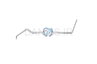 تصویر  سوند اندودنتیک - فالکن