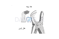 تصویر  فورسپس ساده عقل - فالکن