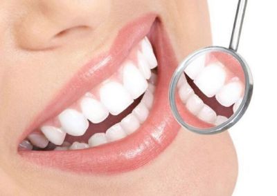 انواع مختلف کامپوزیت دندان و بهترین نوع آن