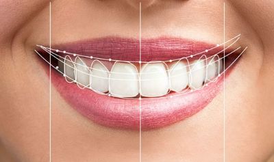 دلایل استفاده از کامپوزیت دندان