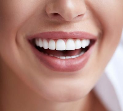 رابطه کامپوزیت دندان و زیبایی چهره