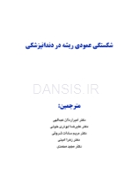 تصویر  شکستگی عمودی ریشه در دندانپزشکی