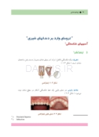 تصویر  ترومای دندانی