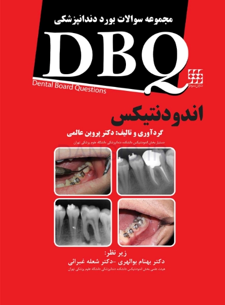 تصویر  DBQ اندودنتیکس (مجموعه سوالات بورد دندانپزشکی)