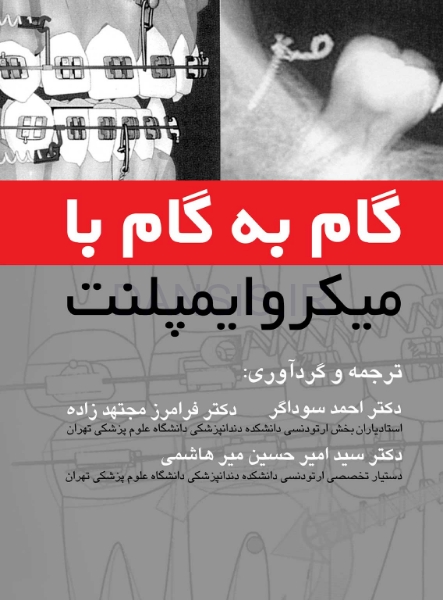 تصویر  گام به گام با میکروایمپلنت