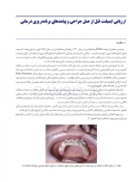 تصویر  عوارض پیچیده ی ایمپلنت های دندانی