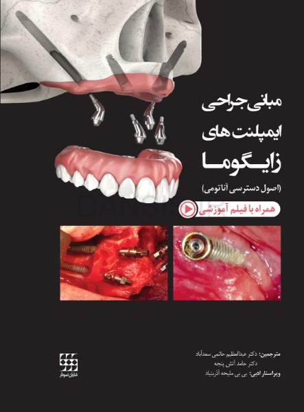 تصویر  مبانی جراحی ایمپلنت های زایگوما (اصول دسترسی آناتومی)