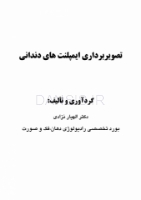 تصویر  تصویربرداری ایمپلنت های دندانی