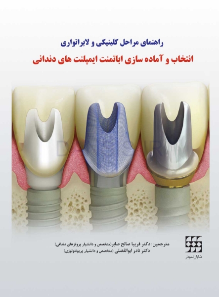 تصویر  راهنمای مراحل کلینیکی و لابراتواری انتخاب و آماده‌سازی اباتمنت ایمپلنت‌های دندانی