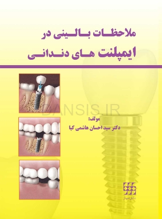 تصویر  ملاحظات بالینی در ایمپلنت های دندانی