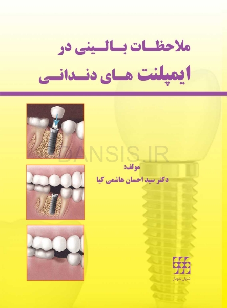 تصویر  ملاحظات بالینی در ایمپلنت های دندانی