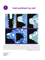 تصویر  ایمپلنت در یک نگاه