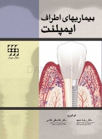 تصویر  بیماریهای اطراف ایمپلنت