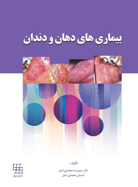 تصویر  بیماری های دهان و دندان