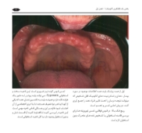 تصویر  گام به گام با BPS