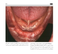 تصویر  گام به گام با BPS