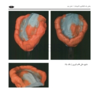 تصویر  گام به گام با BPS