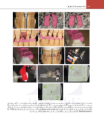 تصویر  اصول نوین در پروتزهای دندانی رزنتال 2023 (جلد دوم)