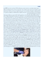 تصویر  همه می توانند به پروتز کامل فک پایین با ساکشن دست یابند SEMCD