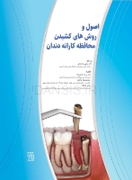تصویر  اصول و روش های کشیدن محافظه کارانه دندان