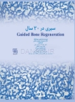 تصویر  Guided Bone Regeneration سیری در 30 سال