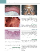 تصویر  پاتولوژی دهان، فک و صورت نویل 2024 جلد یک (رنگی)