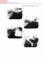 تصویر  اطلس رادیوگرافیک آناتومی و پاتولوژی دندانی