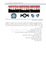 تصویر  دندانپزشکی ترمیمی دیجیتال (فصول برگزیده)