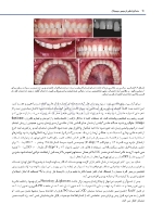 تصویر  دندانپزشکی ترمیمی دیجیتال (فصول برگزیده)