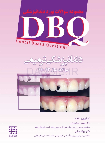 تصویر  DBQ دندانپزشکی ترمیمی مجموعه سوالات بورد دندانپزشکی (سوالات سال 93 تا 99)