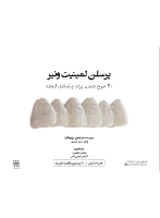 تصویر  پرسلن لمینیت ونیر(20 طرح درمان برای بازسازی لبخند)