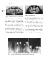 تصویر  اصول جراحی دهان فک و صورت پیترسون 2022 (جلد دوم)