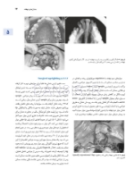 تصویر  اصول جراحی دهان فک و صورت پیترسون 2022 (جلد دوم)