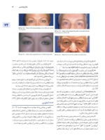 تصویر  اصول جراحی دهان، فک و صورت پیترسون 2022 زیبایی – جلد چهارم