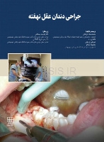 تصویر  جراحی دندان عقل نهفته