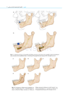 تصویر  راهنمای مصور جراحی ارتوگناتیک