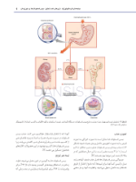 تصویر  استئونکروز فکین ناشی از مصرف داروها