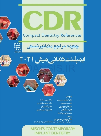 تصویر  CDR ایمپلنت دندانی میش 2021 (چکیده مراجع دندانپزشکی)