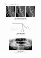 تصویر  نمونه سوالات بخش اسلایدها در آزمون بورد عملی جراحی دهان، فک و صورت