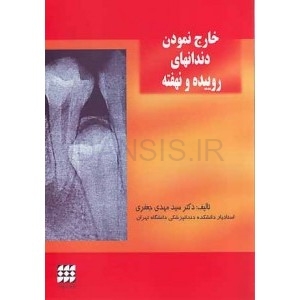 تصویر  خارج نمودن دندانهای روییده و نهفته