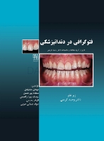 تصویر  فتوگرافی در دندانپزشکی