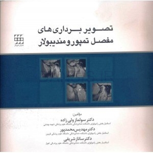 تصویر  تصویر برداری های مفصل تمپورومندیبولار