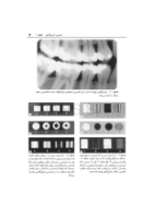 تصویر  ضروریات رادیوگرافی دندانپزشکی
