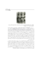تصویر  رادیولوژی و آناتومی دهان