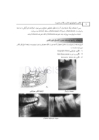 تصویر  اطلس رادیولوژی دهان و فک و صورت
