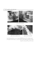 تصویر  اطلس رادیولوژی دهان و فک و صورت