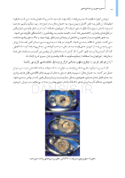 تصویر  میکروسکوپ در دندانپزشکی (یک مقاله گروهی برای دندانپزشکان حرفه ای)