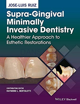 تصویر  Supra-Gingival Minimally Invasive Dentistry A Healthier Approach to Esthetic Restorations