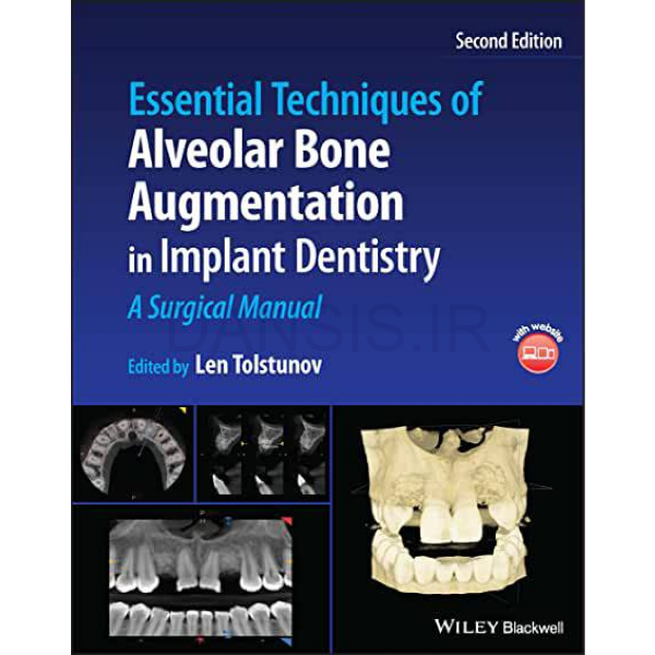 تصویر  Essential Techniques of Alveolar Bone Augmentation in Implant Dentistry: A Surgical Manual 2e 2023
